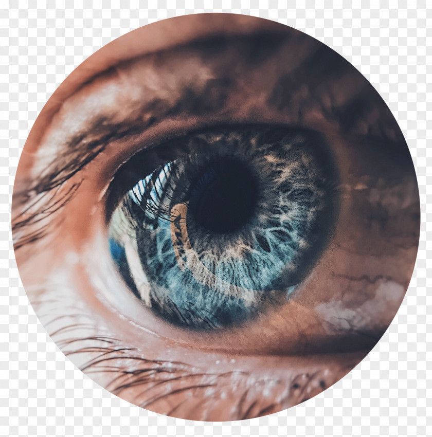 LASIK/PRK/TSA Eye Surgery Calgary Contact Lenses United States AnisocoriaHuman Right Clarity Laser Vision PNG
