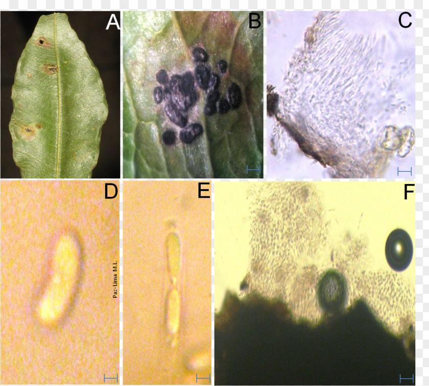 Plant Colletotrichum Sordariomycetes Pathology Fungus PNG