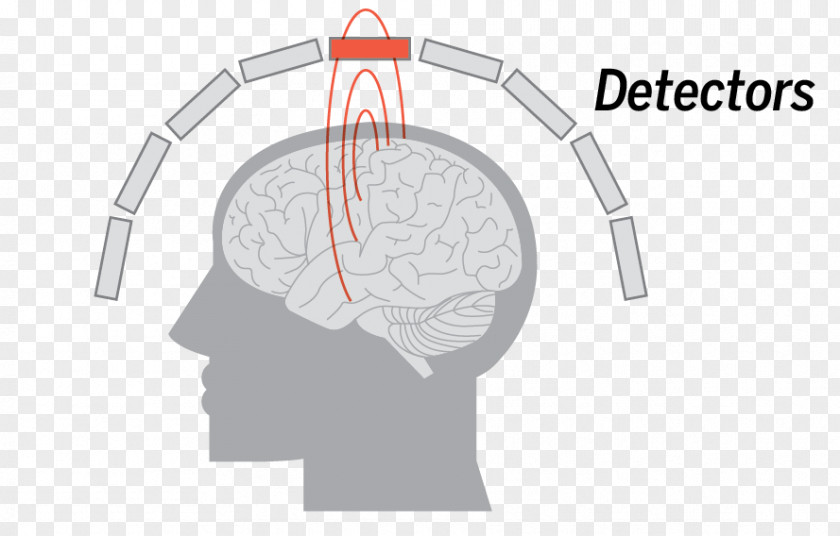 Brain Coronal Plane Mapping Magnetoencephalography Neuroimaging Magnetic Field PNG