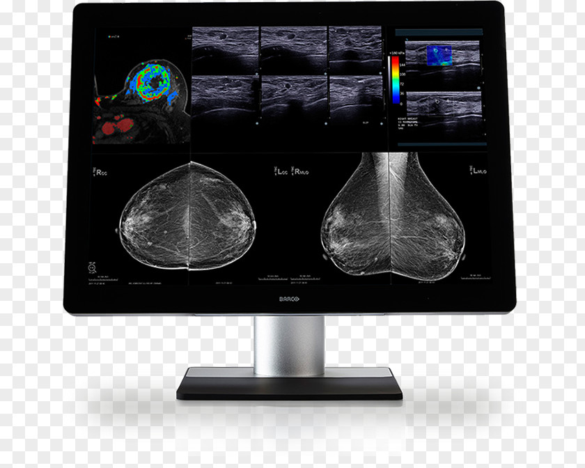 Smooth Sailing Computer Monitors Barco Digital Mammography Medical Imaging PNG