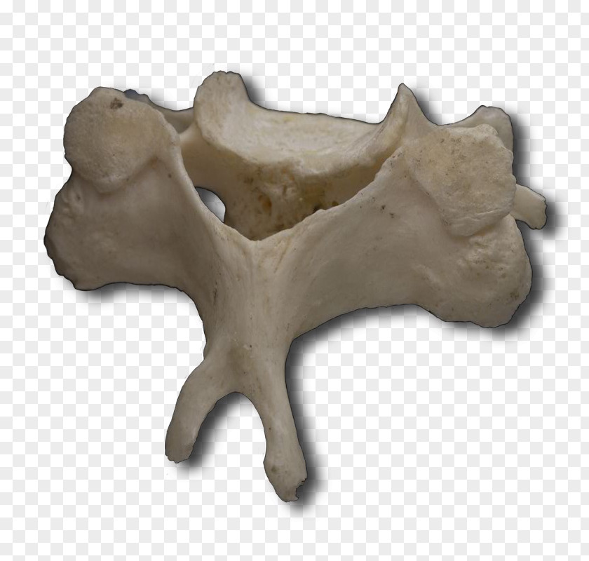 Human Vertebral Column Atlas Cervical Vertebrae PNG