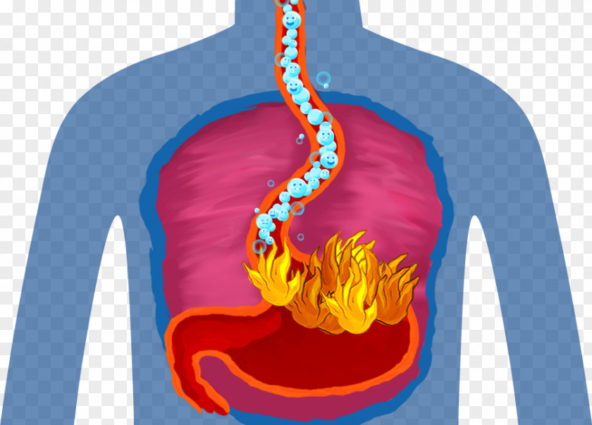 Health Kidney Stone Gout Food Uric Acid PNG