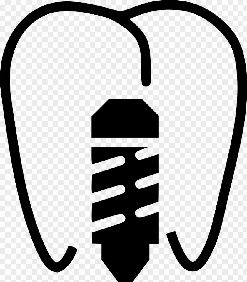 Cosmetic Dentistry Dental Implant Tooth PNG