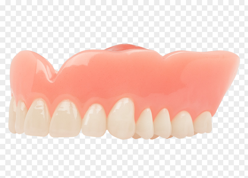 Dentures Tooth Dentistry Aspen Dental Implant PNG
