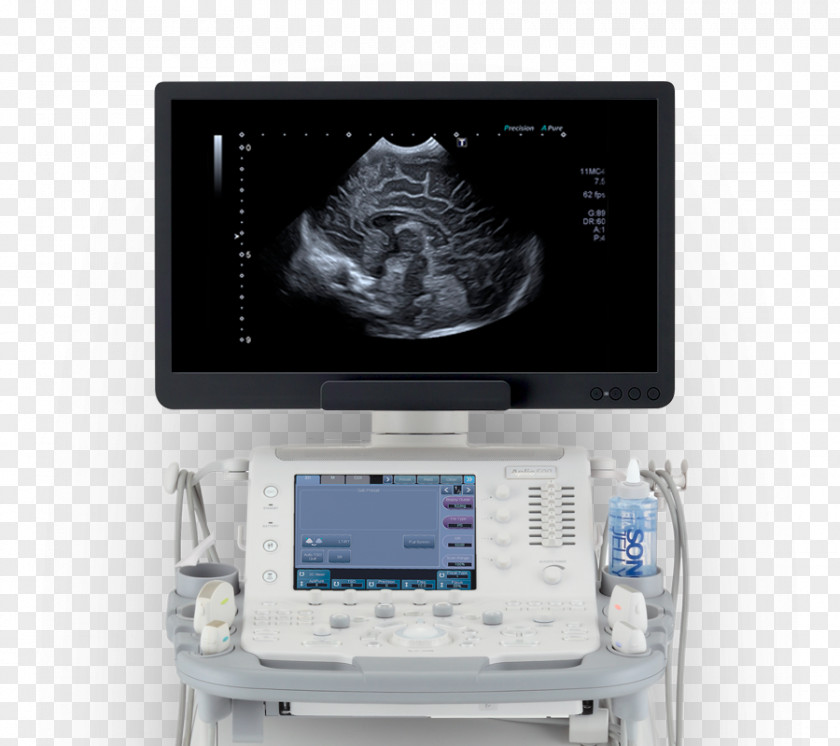 Technology Products Medical Equipment Ultrasonography Medicine Imaging Diagnosis PNG