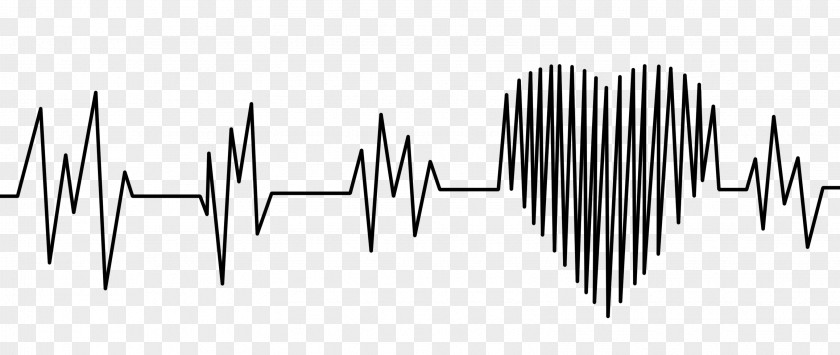 Ecg Heart Electrocardiography Cardiovascular Disease Medicine Pulse PNG