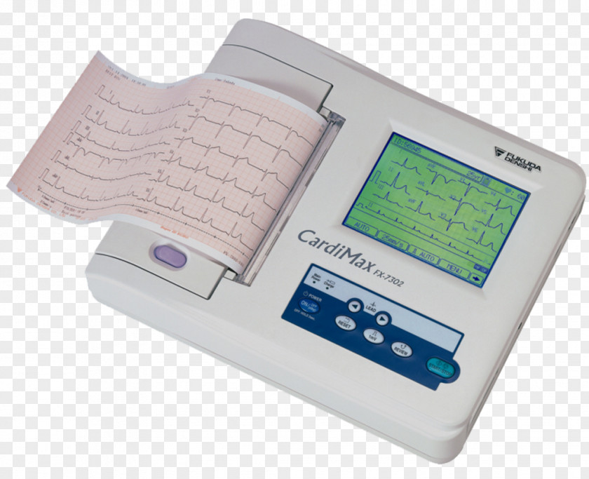 Electrocardiography Medicine Holter Monitor Heart Arrhythmia Electrolyte Imbalance PNG
