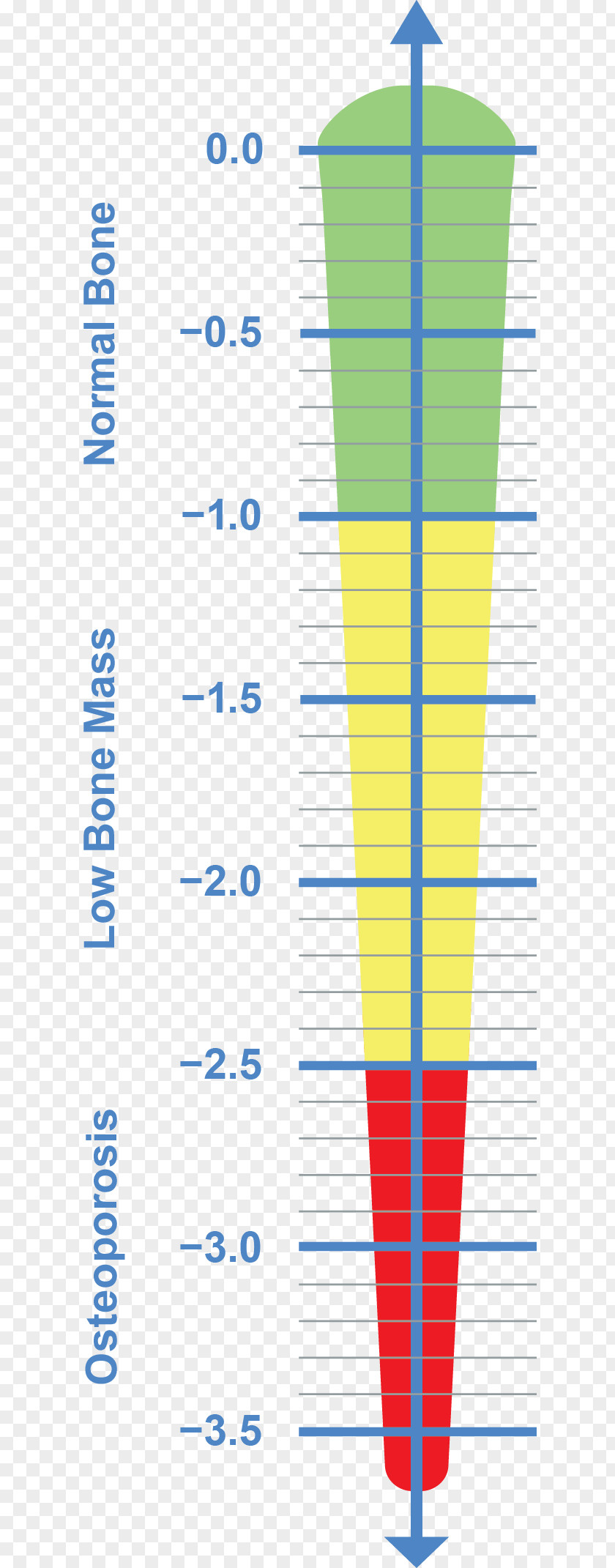 Osteoporosis Teriparatide Bone Density Osteopenia Fracture PNG