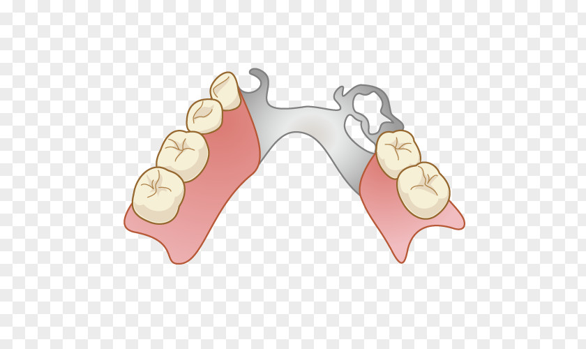 Tooth Dentures Dentist Removable Partial Denture Dental Technician Decay PNG