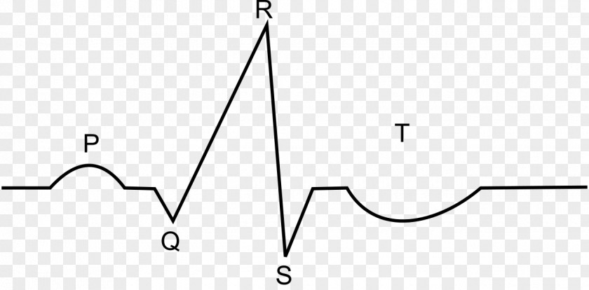 Ekg ECG Interpretation Electrocardiography Atrial Fibrillation Clip Art PNG