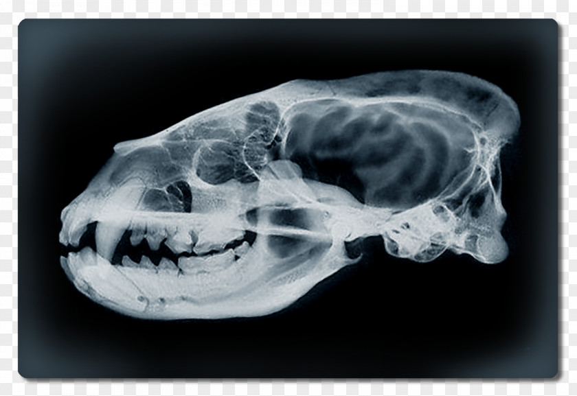 Dessin Crane Computed Tomography Interparietal Bone Skull Medical Radiography PNG