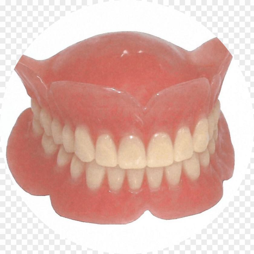 Bridge Dentures Dentistry Removable Partial Denture Dental Implant PNG