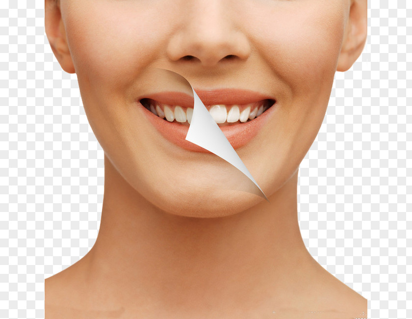 Teeth Whitening Cosmetic Dentistry Tooth Human PNG