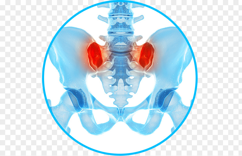Joint Pain Sacroiliac Dysfunction In Spine Management Pelvis PNG