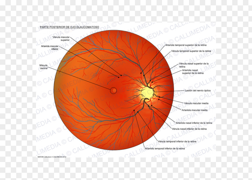 Eye Dilated Fundus Examination Glaucoma Esame Del Fondo Oculare PNG