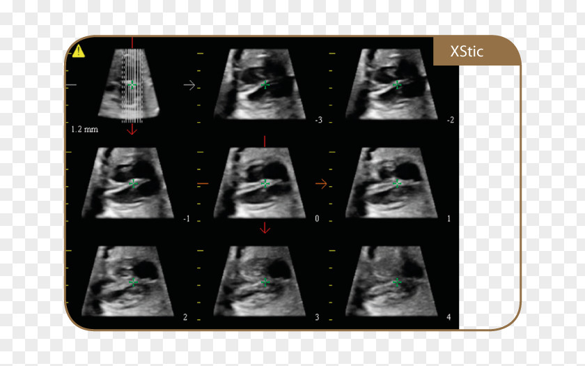 Ultrasonography TWICE Medical Equipment Medicine Magnetic Resonance Imaging PNG