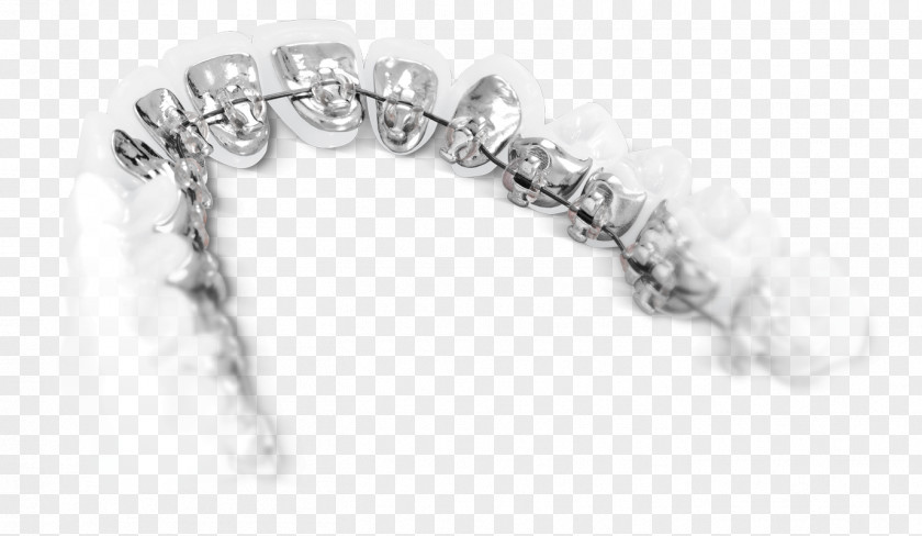 Orthodontics Lingual Braces Dental Tongue Tooth PNG