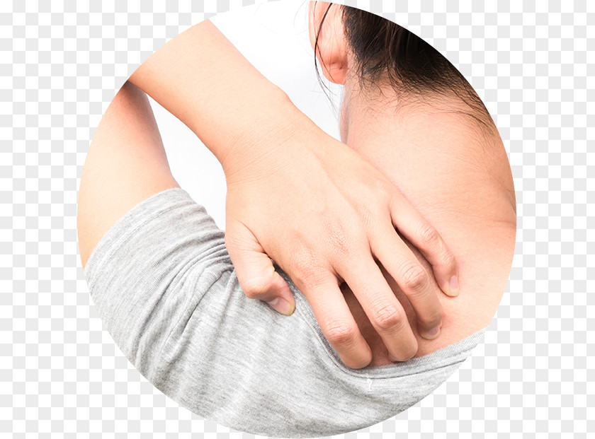 Itch Scabies Skin Rash Dermatology Infection PNG