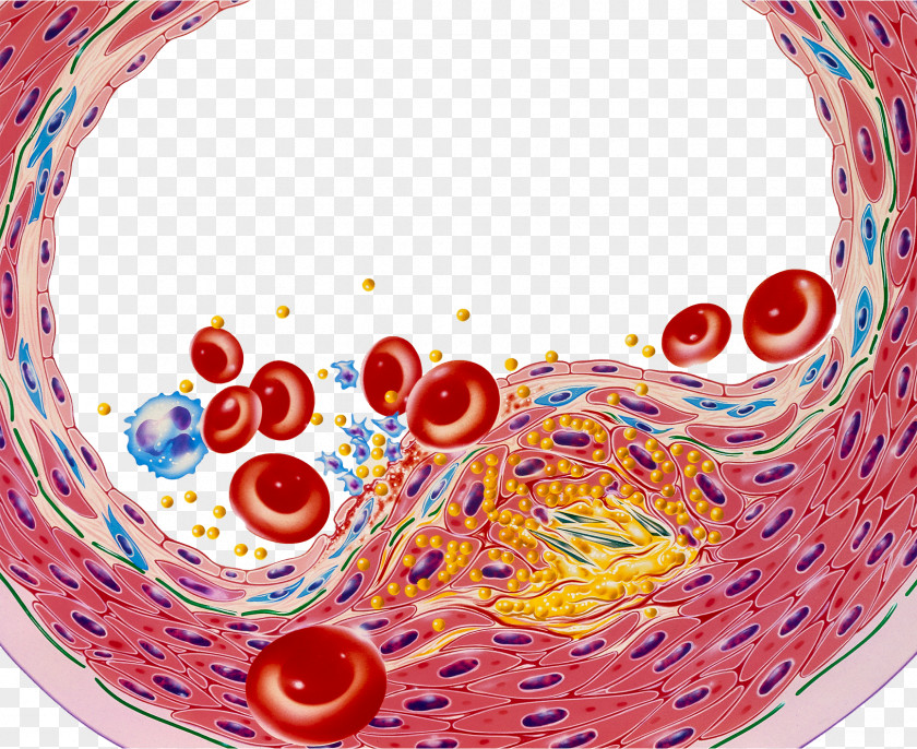 Blood Lipid Cell Illustration Low-density Lipoprotein Arteriosclerosis Platelet PNG