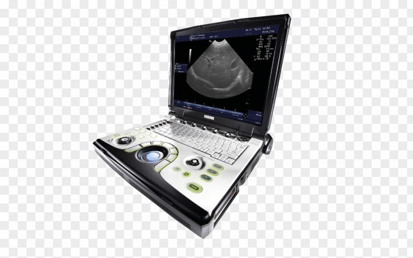 Portatil Portable Ultrasound GE Healthcare Voluson 730 Medical Imaging PNG
