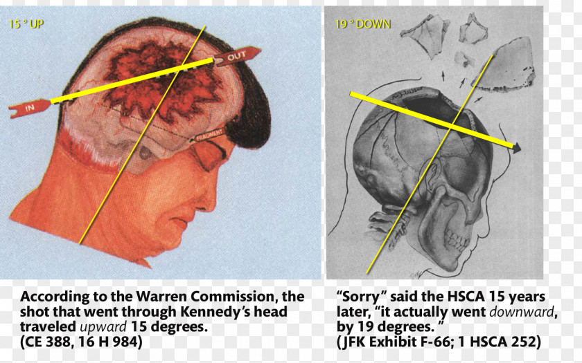 Clea Assassination Of John F. Kennedy Conspiracy Theories Magic Bullet-teorien United States House Select Committee On Assassinations PNG