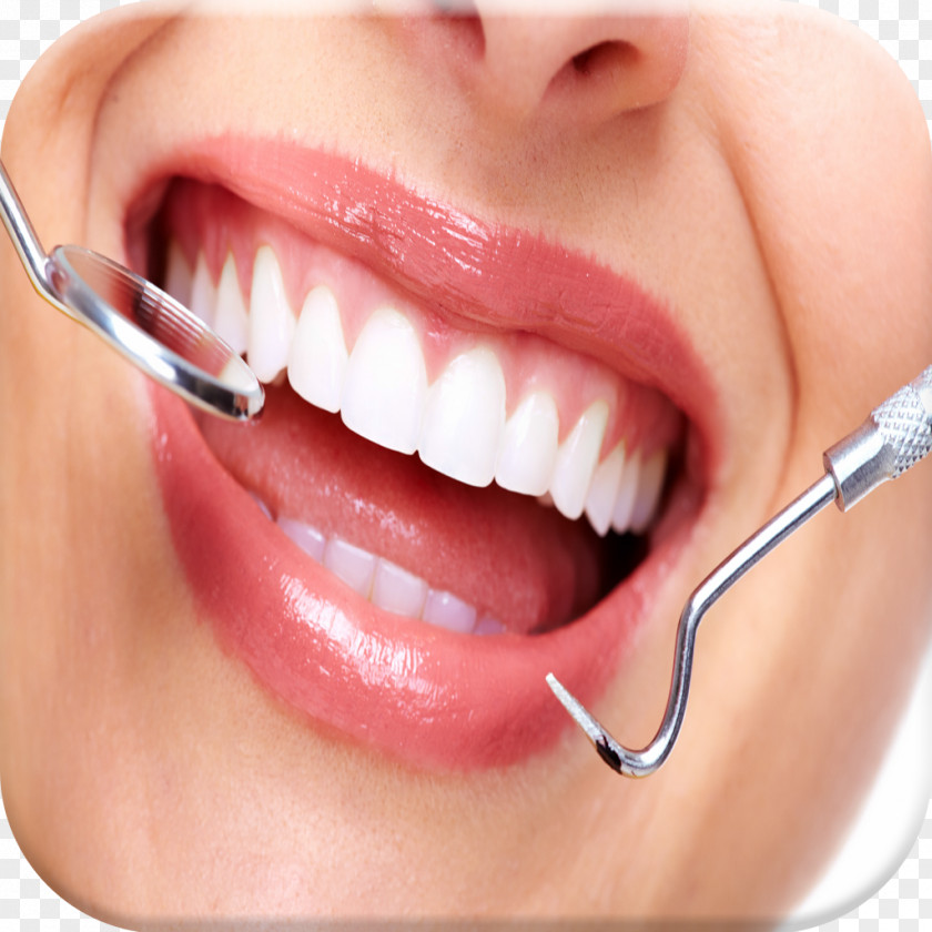 Tooth Dentistry Dental Extraction Surgery PNG