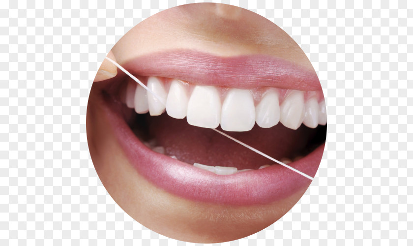 Dental Floss Periodontal Disease Dentistry Human Tooth PNG