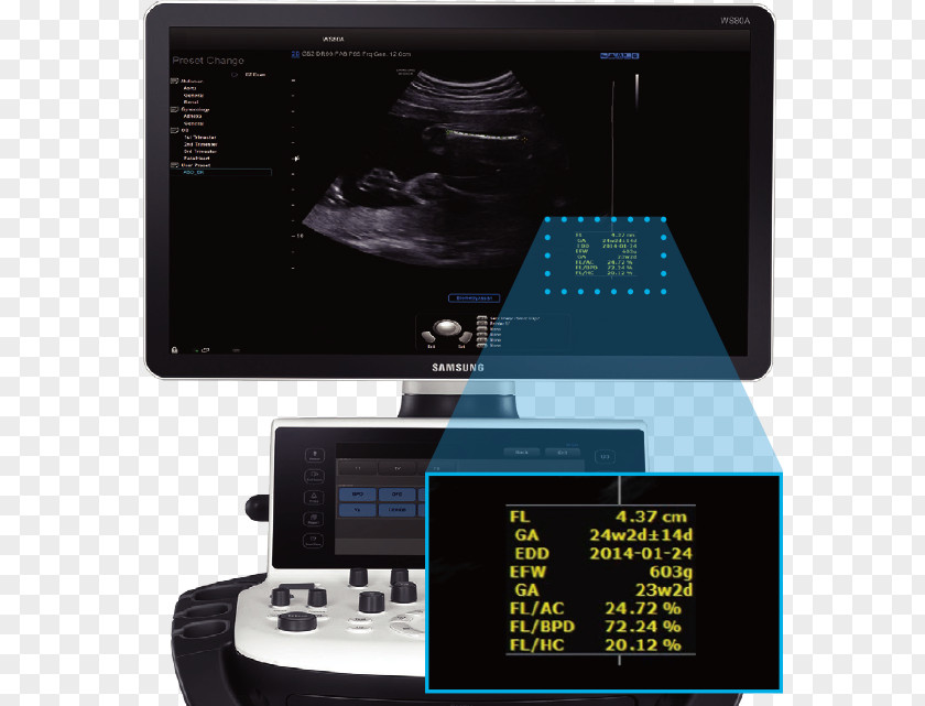 Ob Gyn Pics Ultrasound Ultrasonography Samsung Medison Electronics PNG