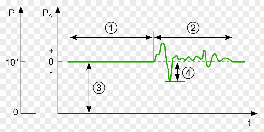 Microphone Sound Pressure Level Decibel PNG