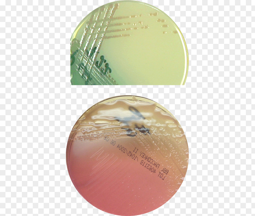 Pseudomonas Burn Wounds Aeruginosa MacConkey Agar PNG