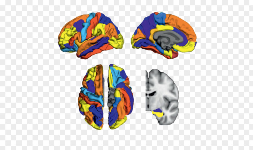 Brain Amyloid Soft Matter Alzheimer's Disease PNG