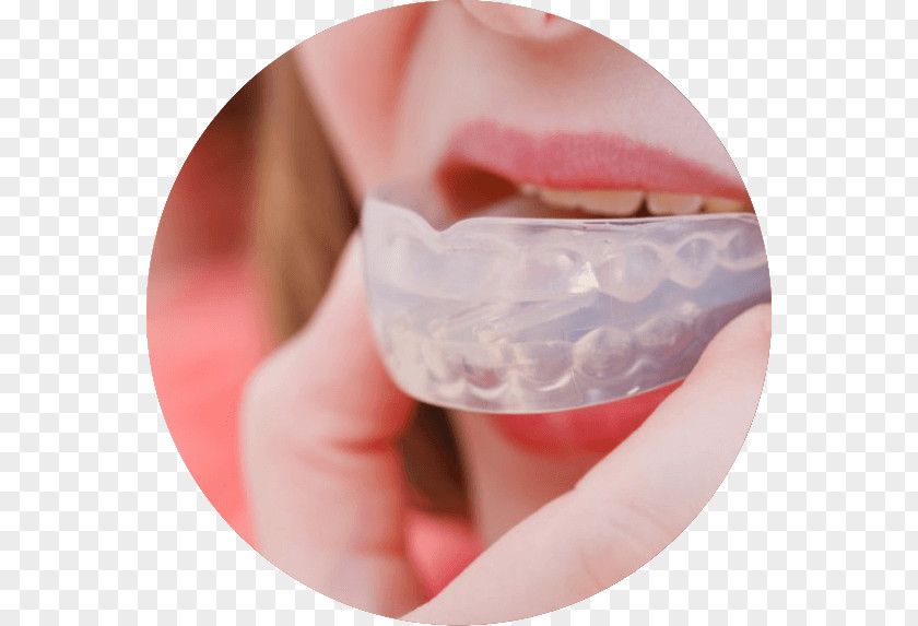 Orthodontic Correction Mouthguard Bruxism Dentistry PNG