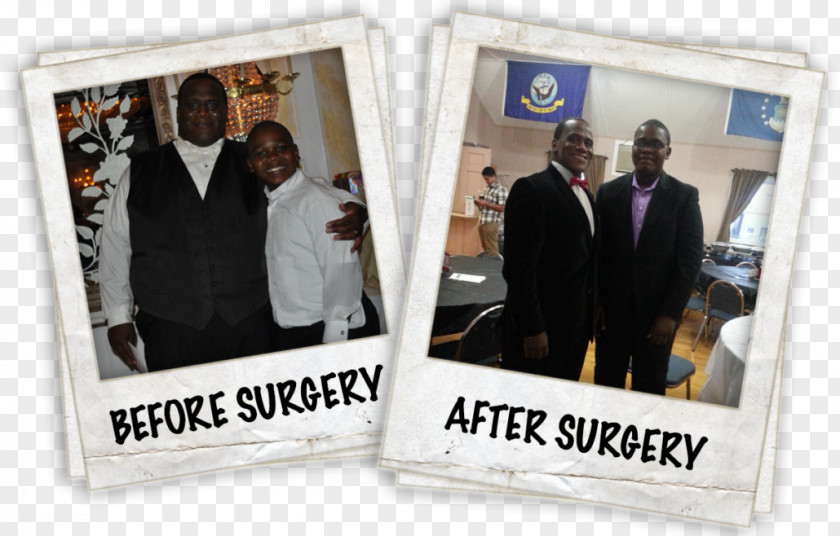 Weight Loss Success Advanced Laparoscopic Surgeons Of Morris, Llc Morristown Memorial: Lewis Christa M DO Bariatric Surgery Gastric Bypass PNG