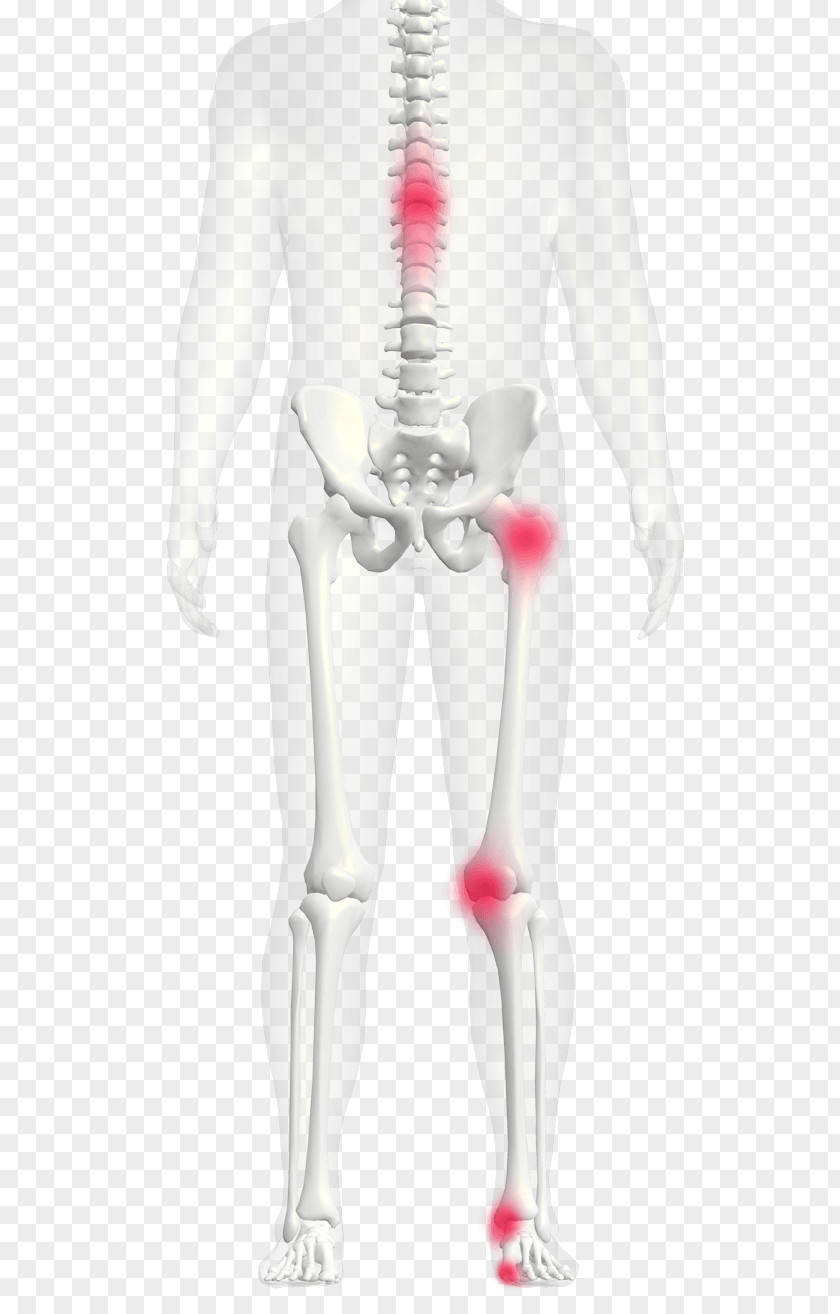 Flat Feet Human Leg Arm Arches Of The Foot PNG feet leg of the foot, hijama pain relief clipart PNG