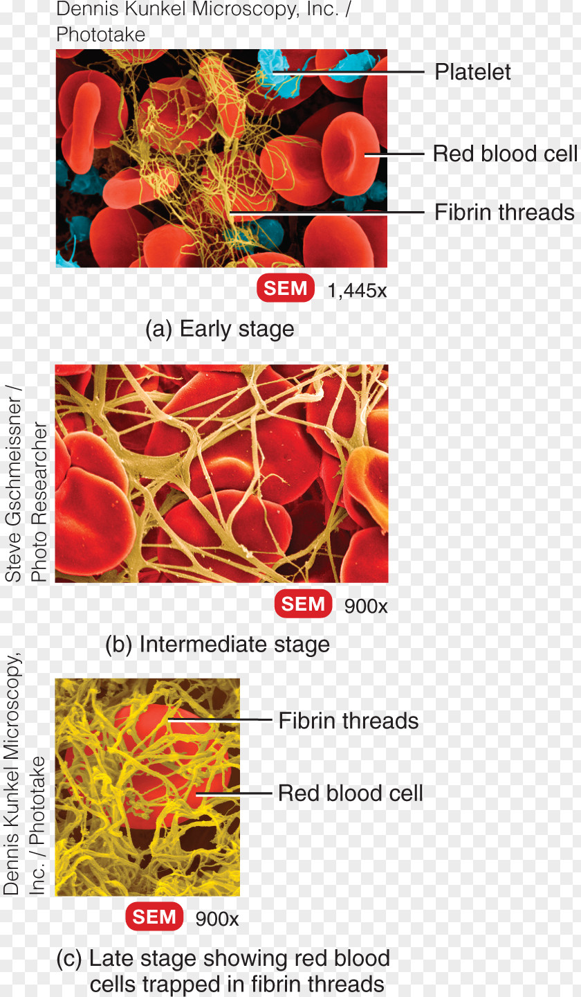 Blood Principles Of Anatomy And Physiology Fibrin Coagulation Thrombus PNG