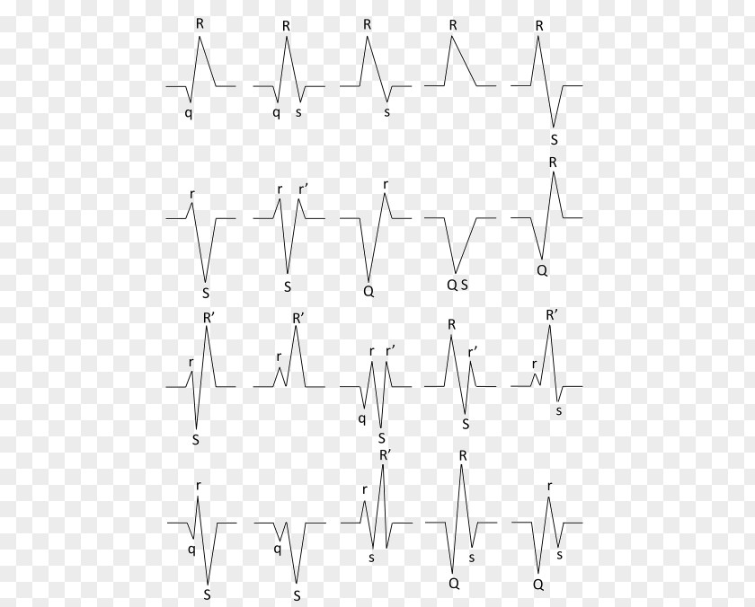 Qrs Accessory Pathway Product Angle Point Pattern Font PNG