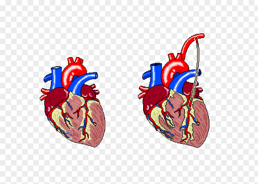 A Bundle Of Balloons Heart Rate Electrocardiography Cardiac Muscle Myocardial Infarction PNG