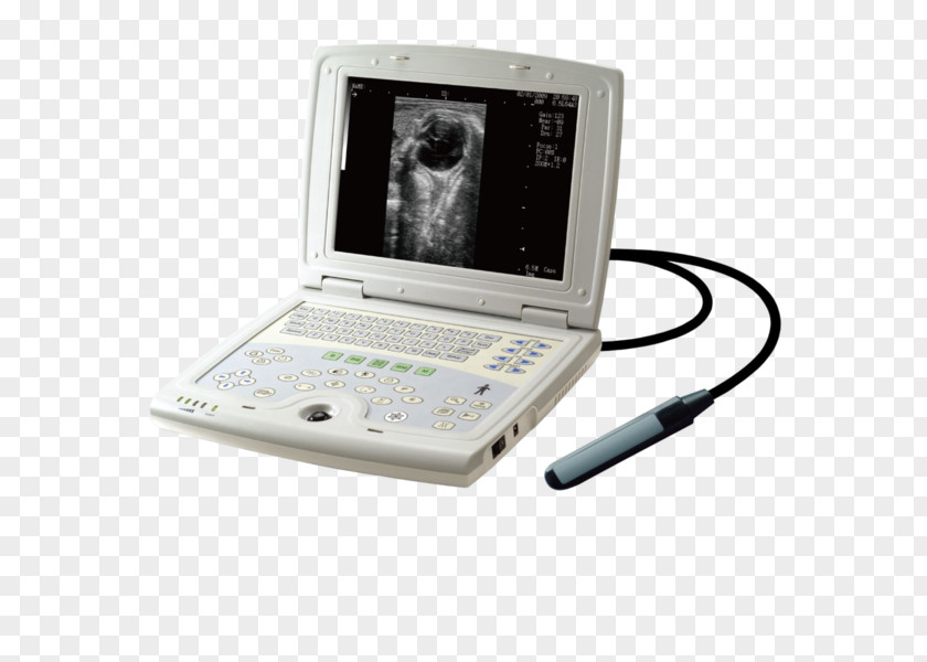 Ultra Sound 3D Ultrasound Ultrasonography Diagnostic Equine PNG