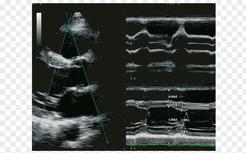 Advanced Technology Ultrasonography Ultrasound Cardiology Ecógrafo Radiology PNG