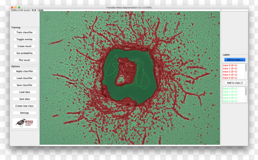 Plant Segmentation Line ImageJ Image Analysis PNG