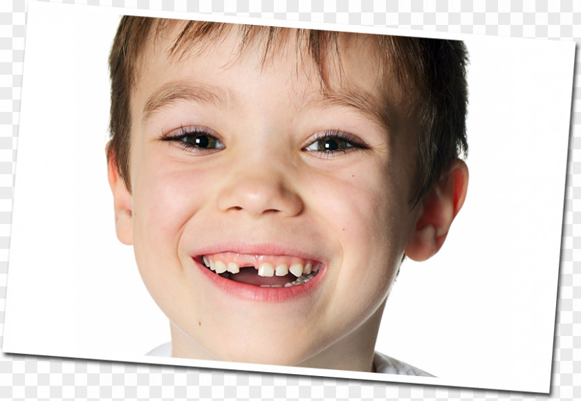 Front Teeth Stock Photography Royalty-free PNG