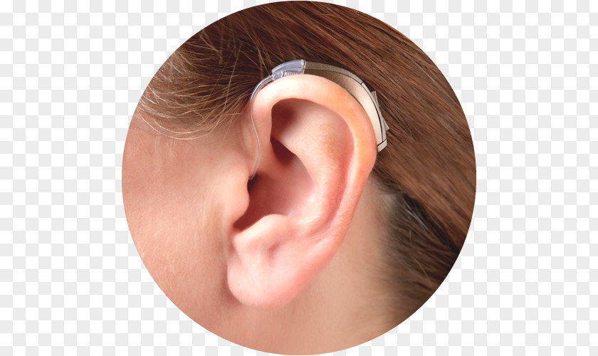 Ear Hearing Aid Loss Acoustics PNG