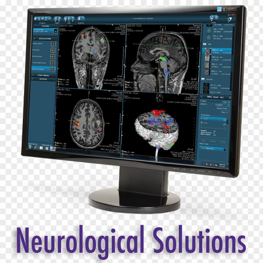 Rebound Orthopedics Neurosurgery Customer Patient Resource Medicine PNG