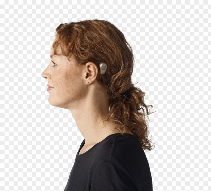 Ears Bone-anchored Hearing Aid Ear Pain Cochlear Implant PNG
