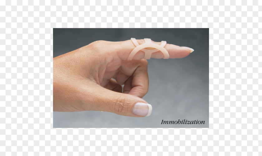 Hand Thumb Splint Swan Neck Deformity Mallet Finger Boutonniere PNG
