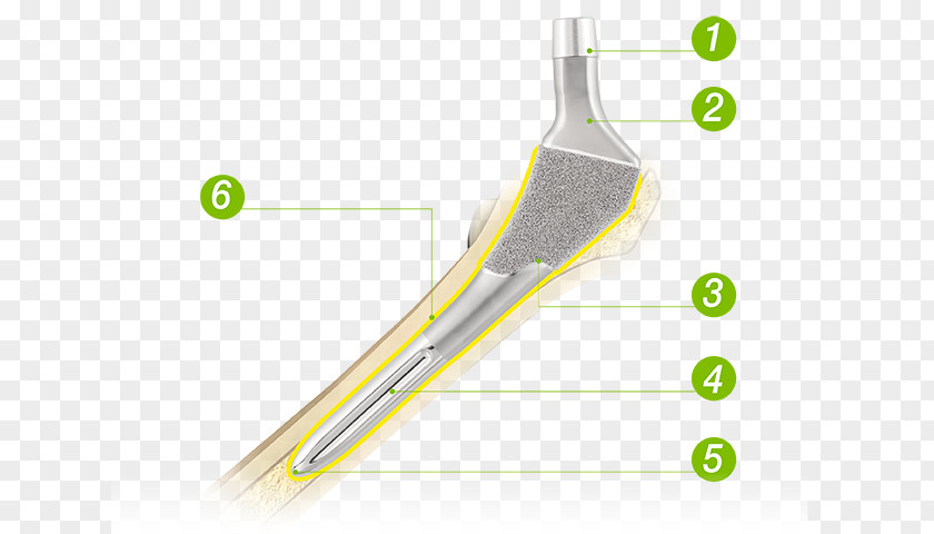 Integrated Machine U2 U-Motion II 13061044~3270/14063844~5670/12035028~5640/14061064~1844 Yellow PNG