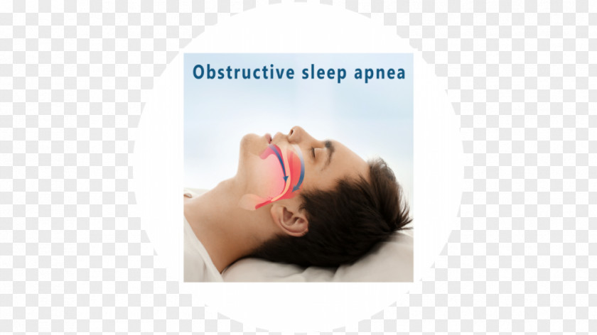 Sleep Apnea Obstructive In Adults PNG