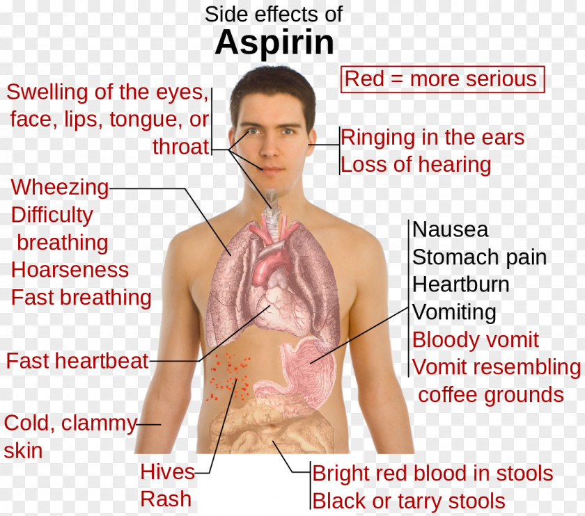 Health Aspirin Salicylate Poisoning Pharmaceutical Drug Adverse Effect Ibuprofen PNG