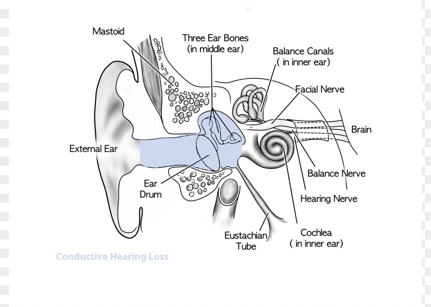 Ear Sensorineural Hearing Loss Conductive PNG