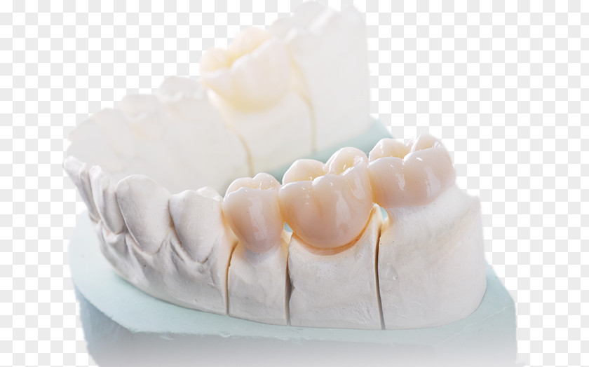 Colorful Shading Dentistry Jaw Dental Restoration Zirconium Dioxide Wholesale PNG